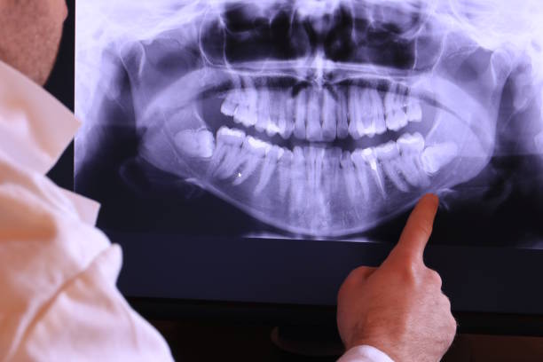 Best Emergency Root Canal Treatment in Chase, PA