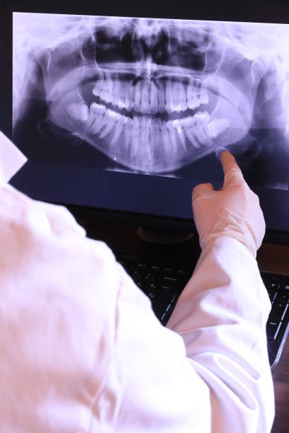 Best Emergency Tooth Extraction in Chase, PA