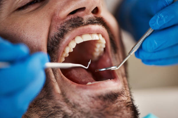 Best Walk-In Emergency Dentist in Chase, PA